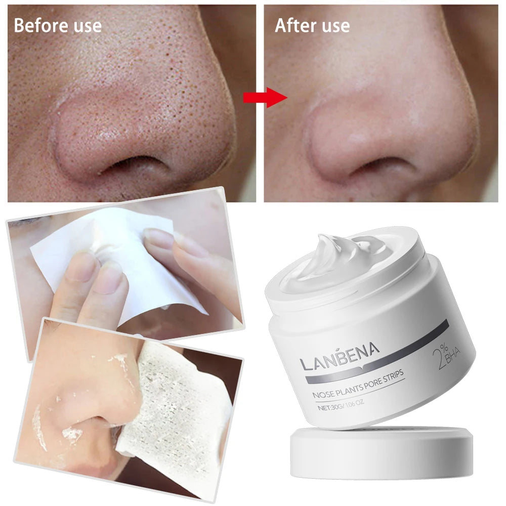 LANBENA Blackhead Remover Mask – Deep Pore Cleanser