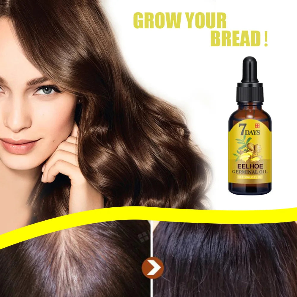 EELHOE Ginger Hair Growth Oil – Natural Hair Care Solution