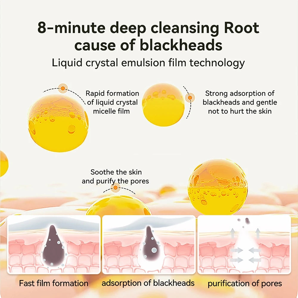 LANBENA Blackhead Remover Mask – Deep Pore Cleanser